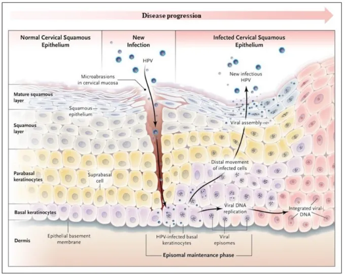 Figure 2: Human papillomavirus life cycle in the squamous epithelium. Reproduced with  permission from Kahn, 2009, Copyright Massachusetts Medical Society (70)