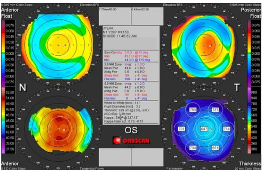 Figure 2. Typical display of a corneal topographer showing information about the corneal 3D shape