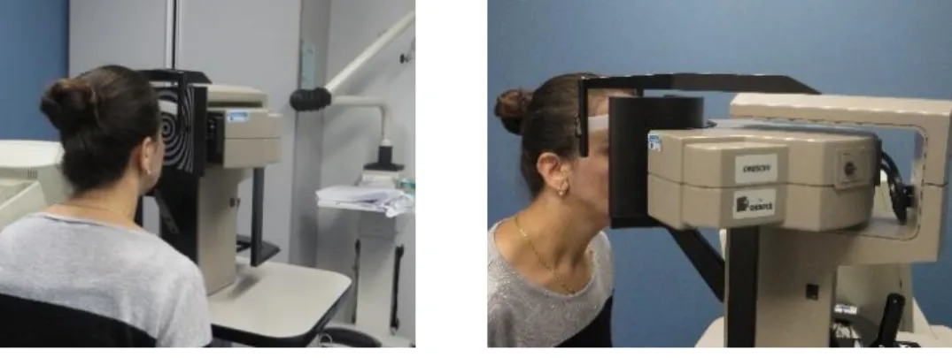 Figure 4. Illustration of the corneal surface (anterior or posterior) data representation