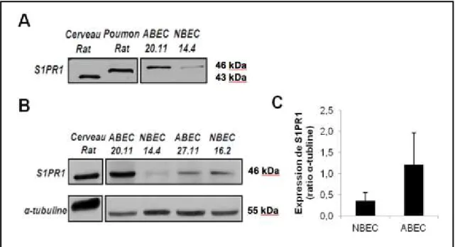 Figure 5. La protéine S1PR1 semble être surexprimée dans les ABEC. 