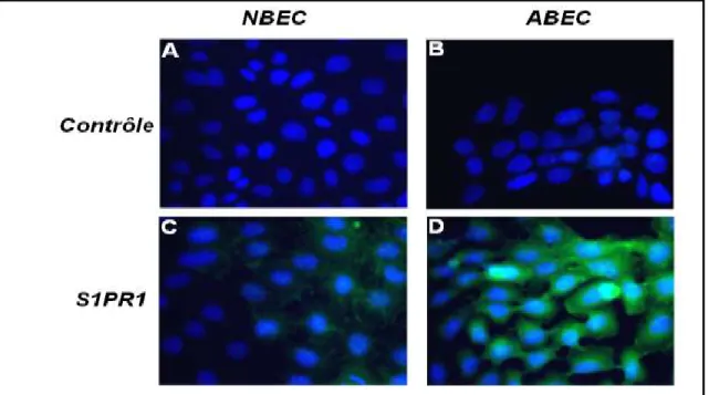Figure 6. Détection par immunofluorescence de S1PR1 dans les ABEC et les NBEC. 