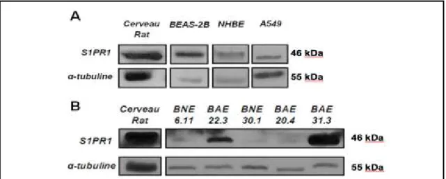Figure  7.  La  protéine  S1PR1  semble  être  surexprimée  dans  les  CE  bronchiques  d’asthmatiques