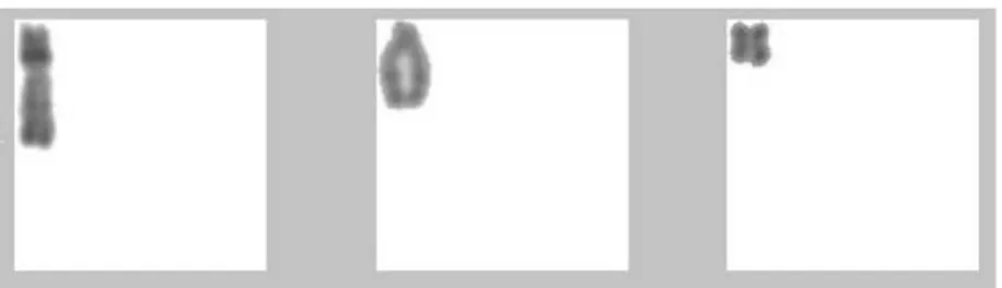 Figure 12: images réduites de chromosomes extraits de la base de données (6, 14 et 19)