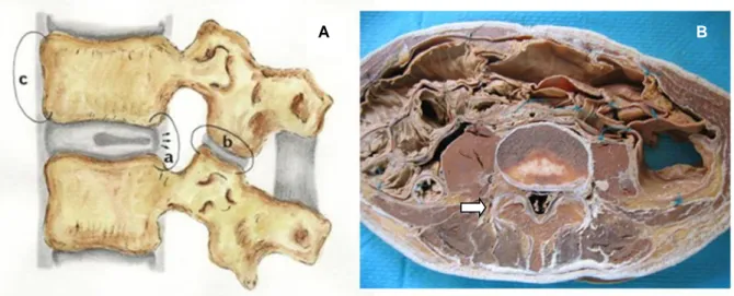 Figure  1 :  Schéma  en  coupe  sagittale  (A)  et  coupe  cadavérique  axiale  (B)  des  articulaires  postérieures  à  l’étage  lombaire