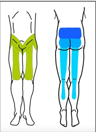 Figure 8 : Territoires d’irradiation  des douleurs facettaires. 