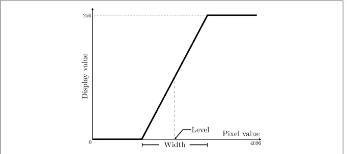 Figure 1.12 VOI transformation. Deﬁned by the window center and window width.
