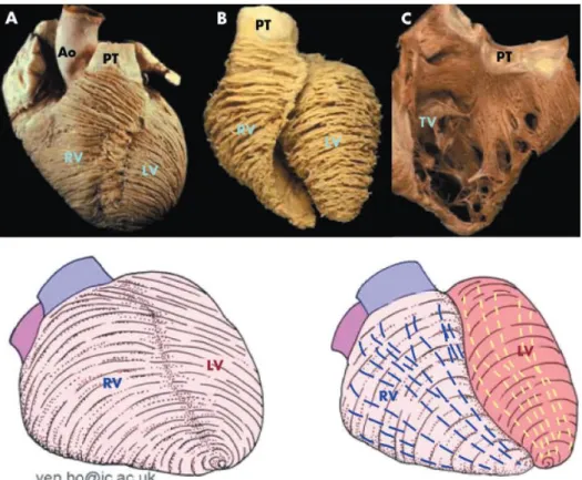 Figure 2 : orientations des fibres myocardiques d’un ventricule droit normal. la majorité des  fibres myocardiques sont disposées de façon longitudinale et non radiale