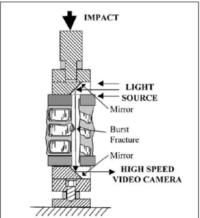 Figure 1.19 Représentation schématique du système de  mesure de l’occlusion du canal rachidien développée 