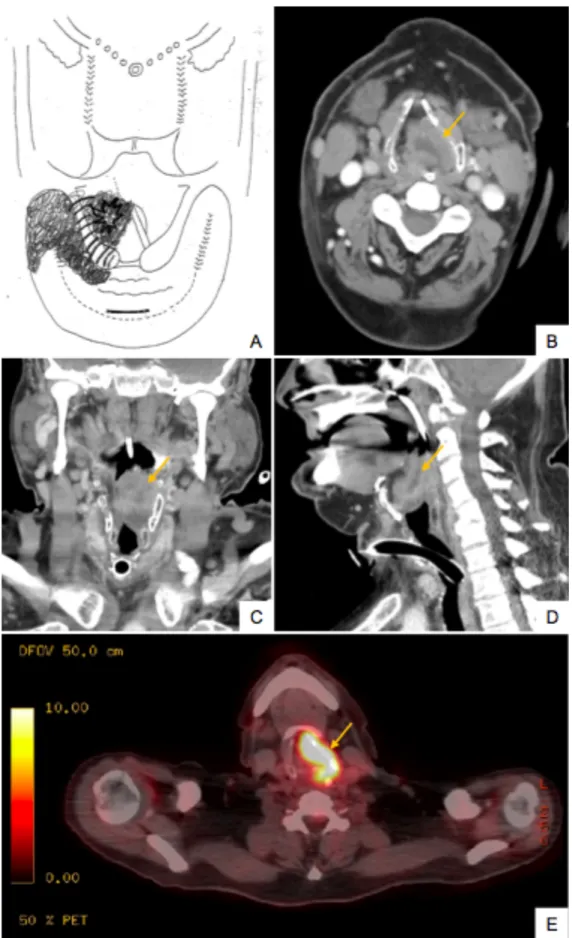 Figure 3 - Corrélation clinique et radiologique 