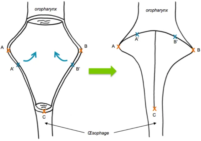 Figure 10 - Principe de la fermeture en T 