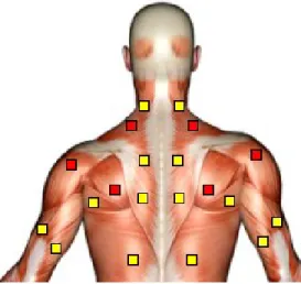 Figure 2. Positionnement des électrodes sur les muscles d'intérêt en rouge.  