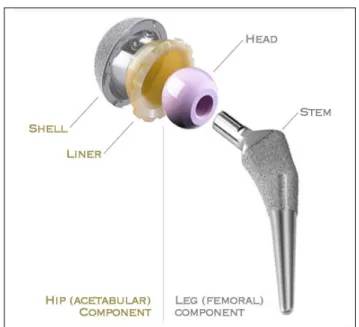 Figure 1.4 Total hip replacement components. 