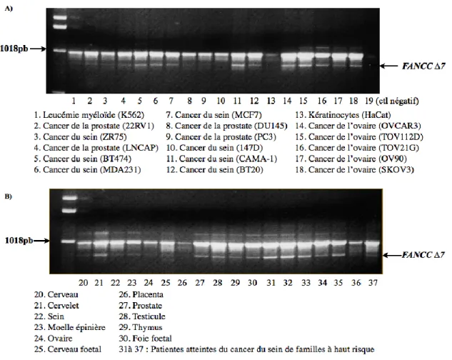 Figure 9. PCR FANCC et FANCCΔ 7: Réactions PCR sur plusieurs lignées cellulaires (1 à 18 et  31  à  37)  où  2  à  18  sont  cancéreuses,  1  provient  d’une  leucémie  myéloïde  et  31  à  38  sont  des  lignées issues de patientes atteintes du cancer du 