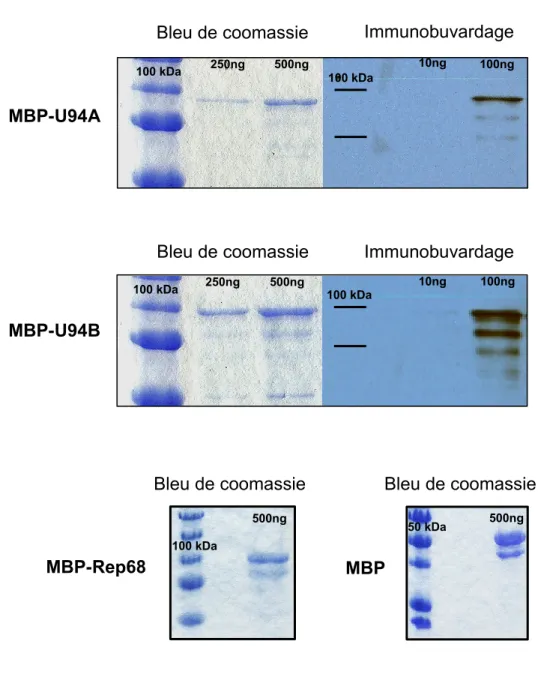 Figure 8 : Immunobuvardage et bleu de coomassie des protéines purifiées 