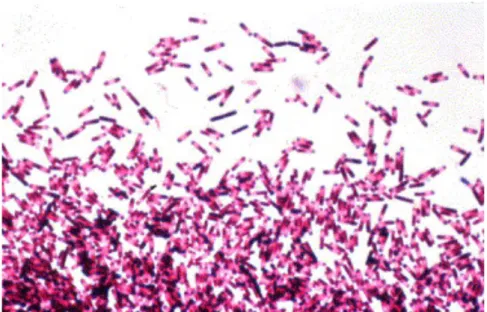 Figure 1 : Coloration de Gram de C.difficile (Buyse et al., 2005) 