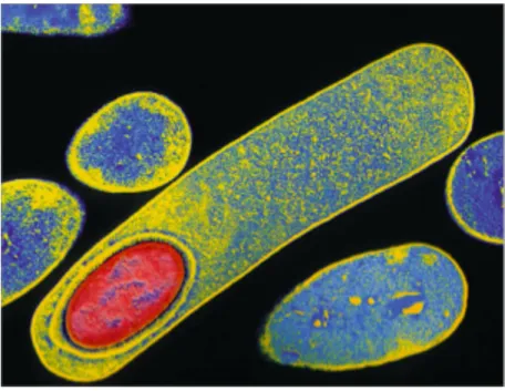 Figure 2 : Spore de C. difficile en microscopie électronique (Aslam et al., 2005) La spore est colorée en rouge au  sein de la bactérie colorée en bleu et jaune