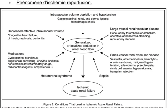 Figure 6 : Conditions entraînant une NTA. Issue de « Acute renal Failure » R. Thadhani and  al