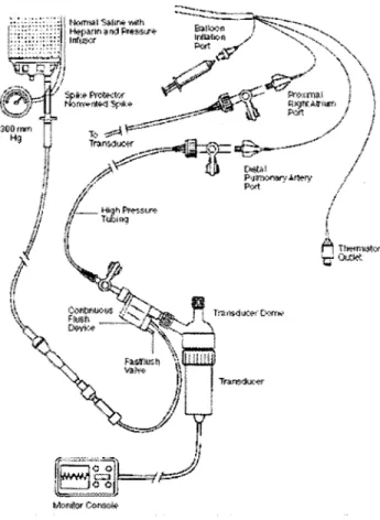 Figure 11  Système extravascu1aire de la mesure de la pression 