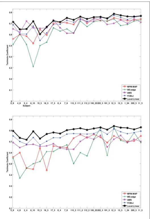 Figure 3.8 Performance index for the 20 normal brain of the IBSR.