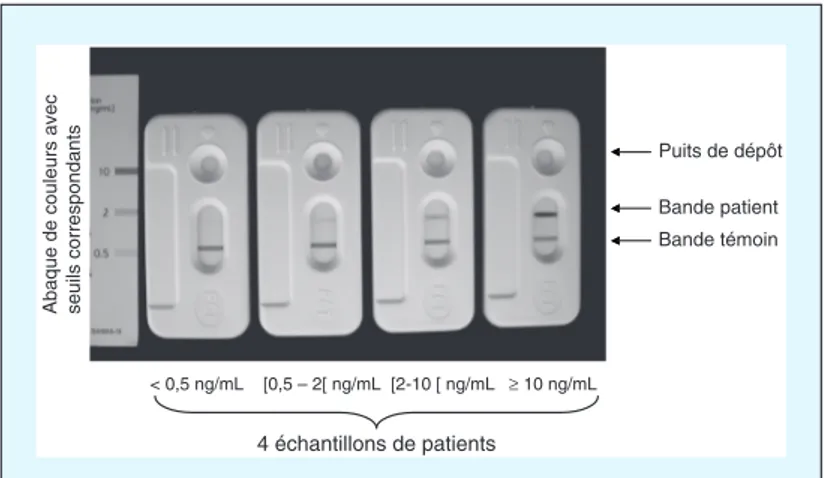 Figure   3   :   Présentation   des   test   unitaires   semi-­‐quantitatifs   PCT-­‐Q   de   quatre   patients   différents
