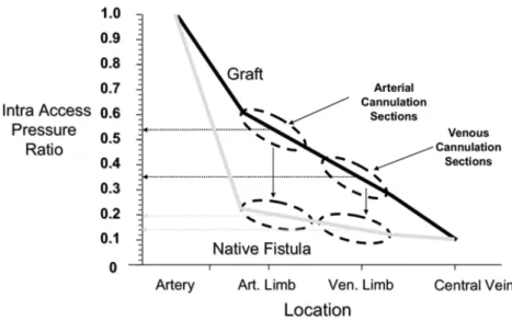 Figure 5: Pression dans l’abord/ pression artérielle moyenne (IAP ratio) dans une FAV native et prothétique  fonctionnelles 