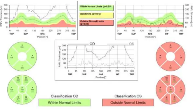 Figure 10 OCT RNFL du 06 02 2018 