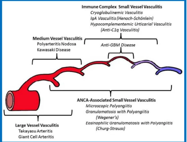 Figure 1. Classification des vascularites selon la conférence de consensus de Chapel-Hill 