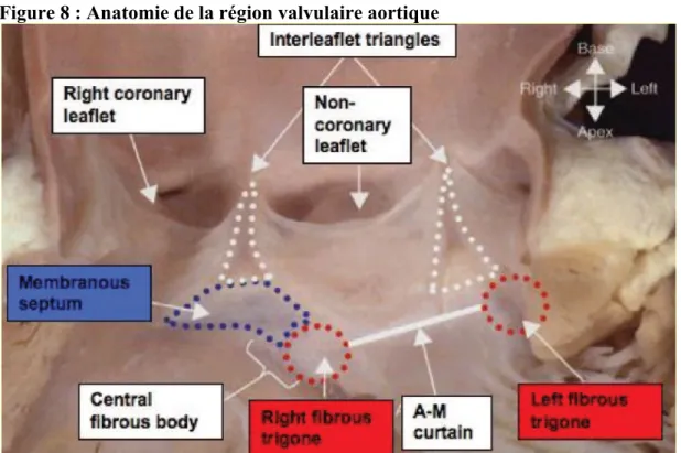 Figure 9 : Rapport anatomique entre la branche gauche de conduction      et les feuillets valvulaires aortiques 
