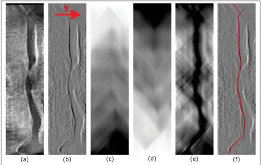 Figure 2.4 Application du chemin minimal sur une image redressée autour du genou aﬁn de segmenter le contour du fémur
