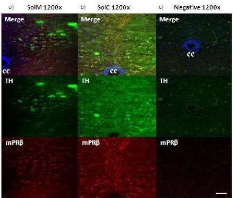 Figure  7  –  Double  Immunofluorescence  for  mPRα  and  TH  in  the  caudal  region  of  the  adult  mouse  brainstem