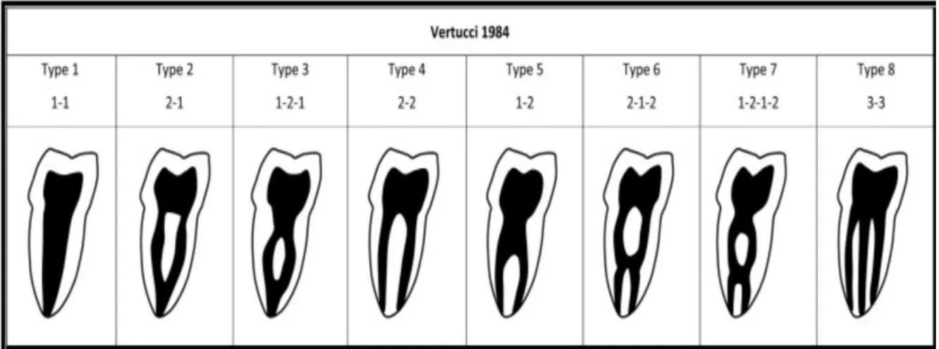 Tableau 1 : Classification Vertucci 1984 