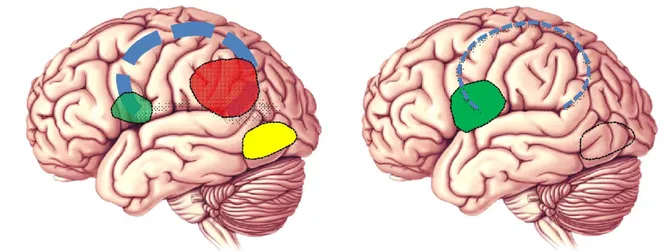 Figure  5  :  Activations  corticales  de  l'hémisphère  gauche  lors  de  la  lecture  de  mots  chez  un  sujet  dyslexique (à droite); chez un sujet témoin (à gauche)