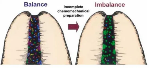 Figure 7 : Une instrumentation incomplète peut favoriser le développement de bactéries  pathogènes et entrainer une réaction inflammatoire péri-radiculaire