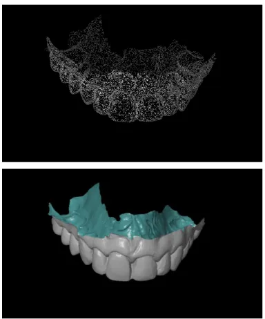 Figure 8 : Nuage de point et STL du maitre modèle virtuel maxillaire 