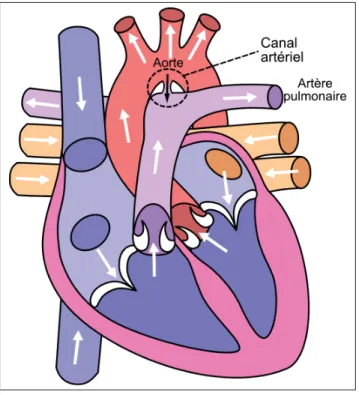 Figure 1.2 Vue antérieure (frontale) du cœur ouvert présentant une persistance du