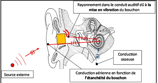 Figure 0.3 : Chemins de transmission en oreille occluse,   source de bruit externe 