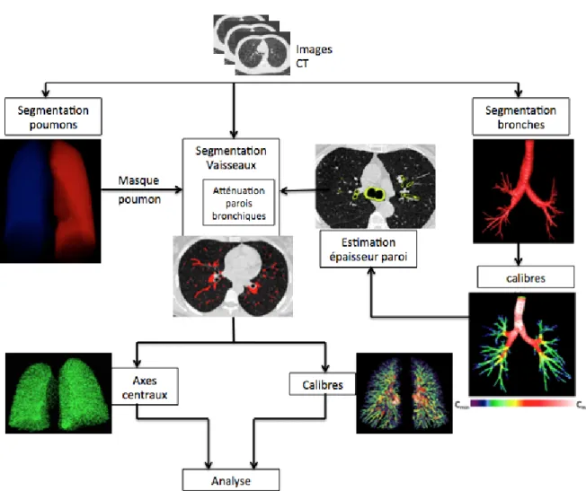 Figure 7 : Résumé des étapes de l'algorithme de segmentation des vaisseaux pulmonaires