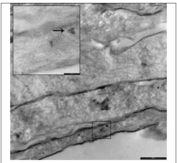 Figure 0-8 Image MET de NP d'argent dans la  couche inférieure du stratum corneum – échelle 