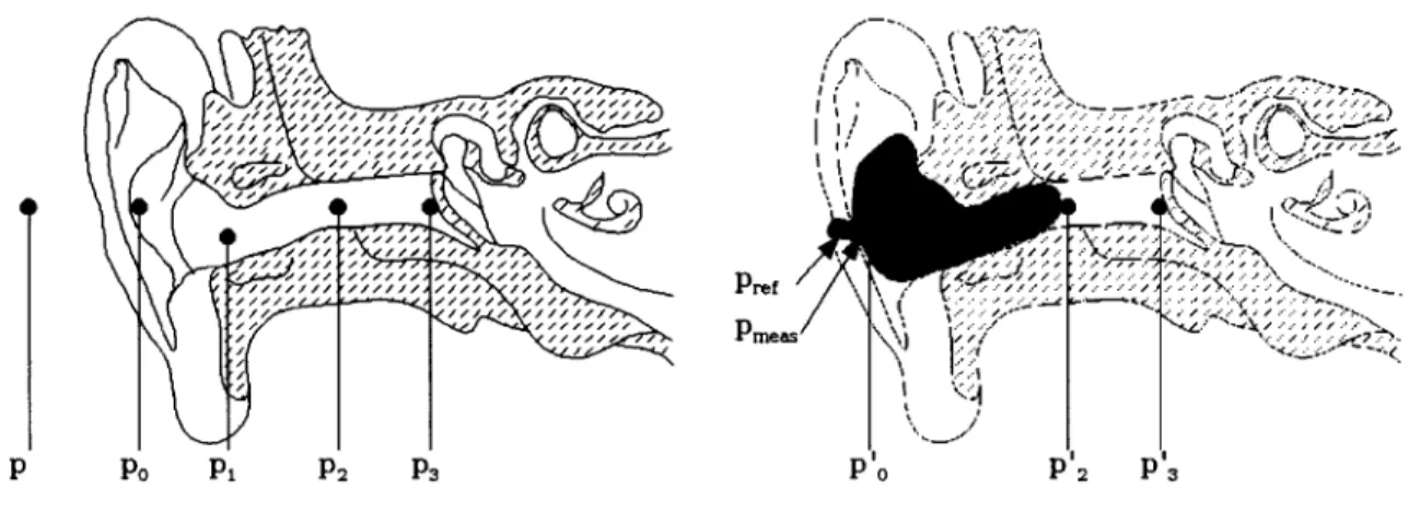 Figure 7  Localisation des points de pression acoustique dans une oreille non protégée  (à gauche) et protégée (à droite) 