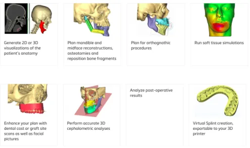 Figure 25 : Le logiciel Simplant® propose des outils de céphalométrie tridimensionnelle, de chirurgie virtuelle,  de simulation des parties molles, ainsi que la possibilité de réaliser des gouttières chirurgicales de conception  assistée par ordinateur et 