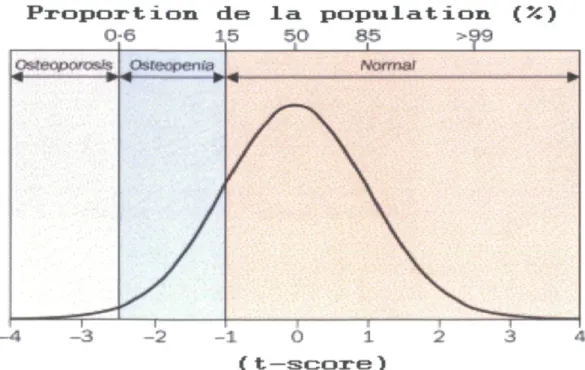 Figure 2: Distribution de la densité osseuse minérale chez les femmes en bonne  santé de 30 à 40 ans et classification du statut ostéoporotique défini par l'OMS