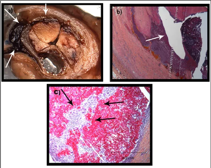 Figure 3.7 A, B Transverse tissue section and histological slide (HPS staining) showing the  presence of an endoleak throughout the CH matrix (arrows) (Dog #6); C inflammation and 