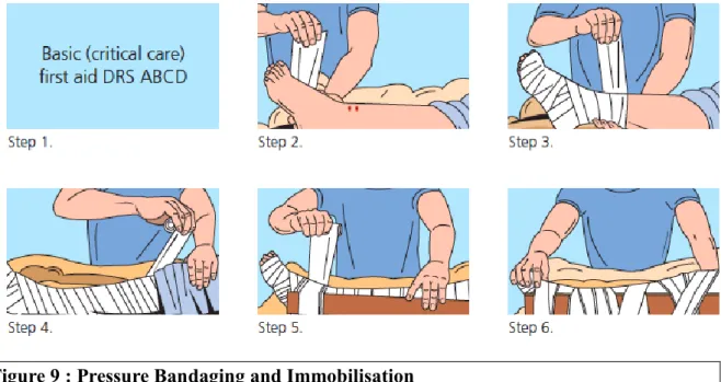 Figure 9 : Pressure Bandaging and Immobilisation 