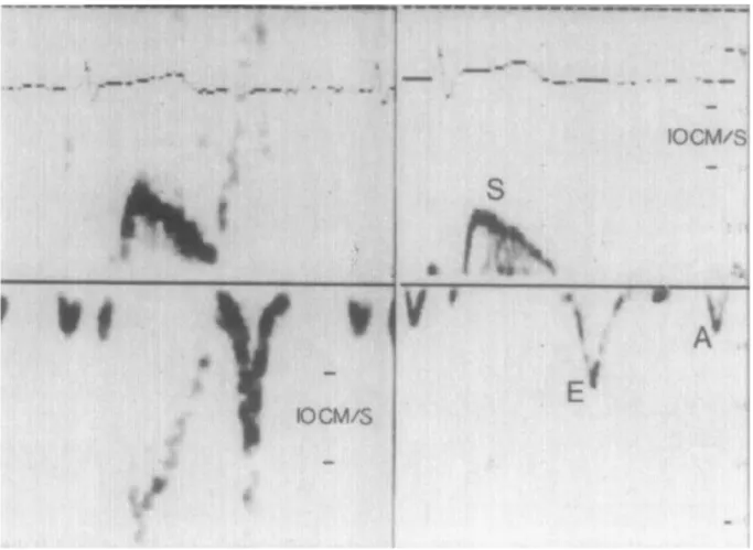 Figure 4 : premières images DTI par ISAAZ en 1989.  12