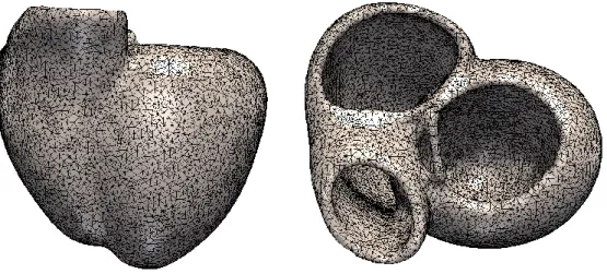 Figure 15 : représentation biventriculaire du  myocarde d’un patient inclus (105000 éléments, 26000  nœuds, ~2.7mm résolution)