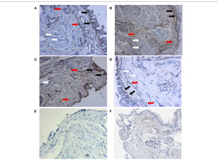 FigUre 1 | representative staining patterns of aTg5 protein expression from each group were shown here: non-asthmatic control (a), mild (B),  moderate (c), and severe (D)