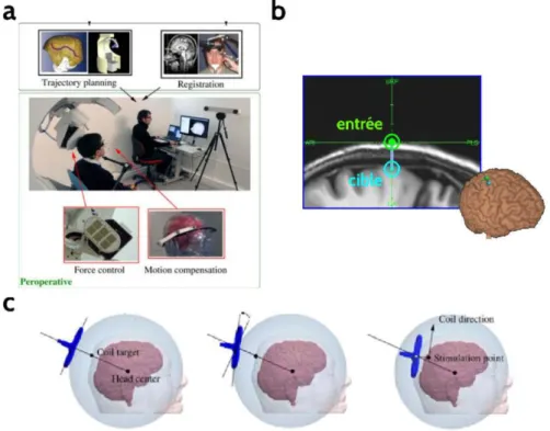 Figure 5. Functioning of the TMS robot developed by Axilum Robotics: a- general principal  of  the  robot-neuronavigation  interface