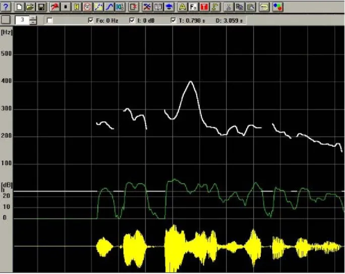 Figure 1 : Visualisation du signal de parole.