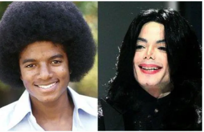 Figure 2 : Michael Jackson, avant-après 