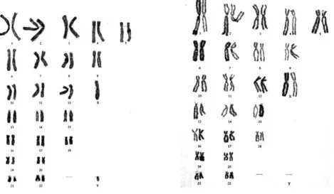 Figure 1: Caryotype masculin                           Figure 2: Caryotype féminin 